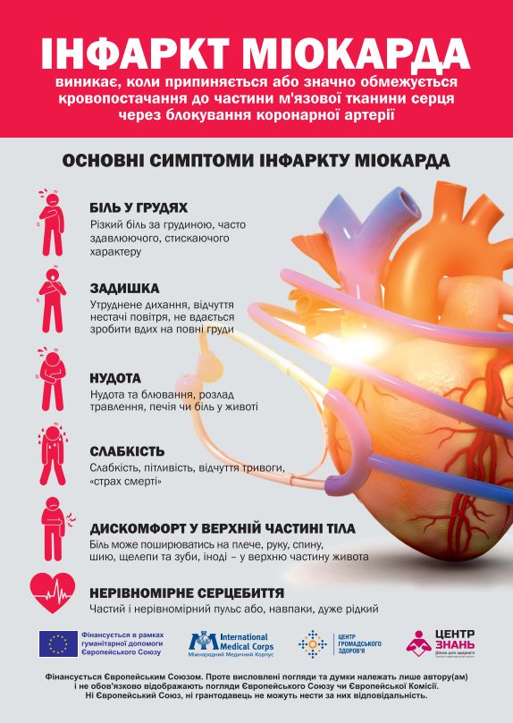 Інфаркт міокарда